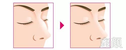 https://img.miyanlife.com/mnt/timg/180531/1014241243-3.jpg