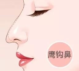 https://img.miyanlife.com/mnt/timg/180531/1014253552-6.jpg
