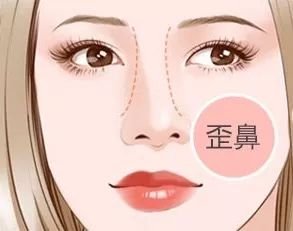 https://img.miyanlife.com/mnt/timg/180531/1014254232-4.jpg