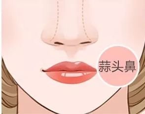 https://img.miyanlife.com/mnt/timg/180531/10142545B-7.jpg