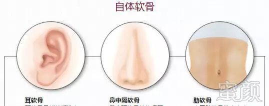 https://img.miyanlife.com/mnt/timg/180531/10294640b-2.jpg