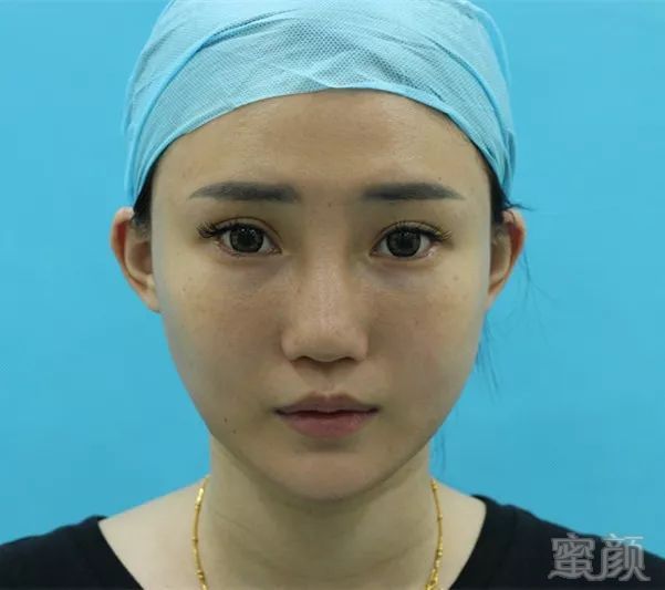 https://img.miyanlife.com/mnt/timg/180531/105T93915-1.jpg