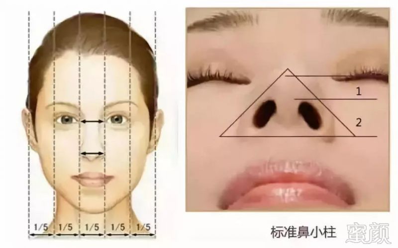 https://img.miyanlife.com/mnt/timg/180531/105U0N64-4.jpg