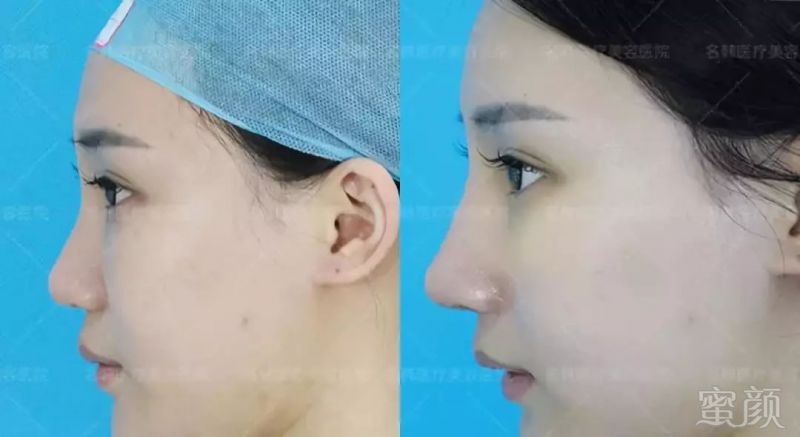 https://img.miyanlife.com/mnt/timg/180531/105U14950-7.jpg