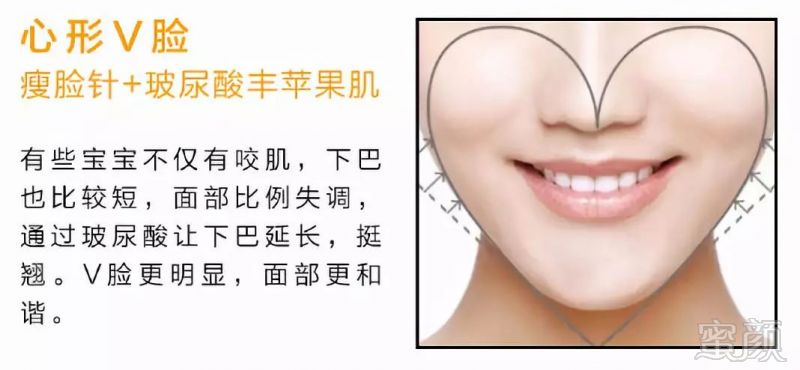 https://img.miyanlife.com/mnt/timg/180531/110P9BZ-7.jpg