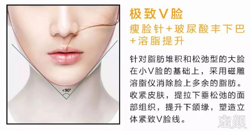 https://img.miyanlife.com/mnt/timg/180531/110PQ947-5.jpg