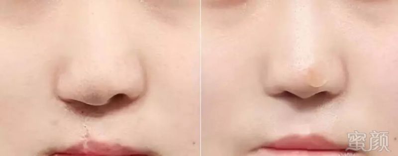 https://img.miyanlife.com/mnt/timg/180531/111SU124-14.jpg