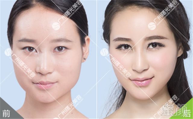 https://img.miyanlife.com/mnt/timg/180531/1126231X6-1.jpg