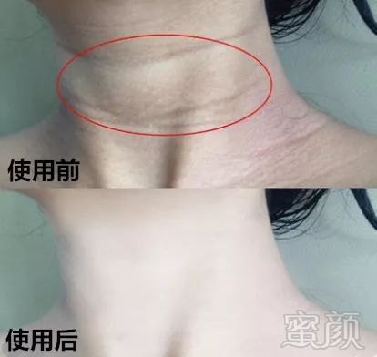 https://img.miyanlife.com/mnt/timg/180531/11292GS4-2.jpg