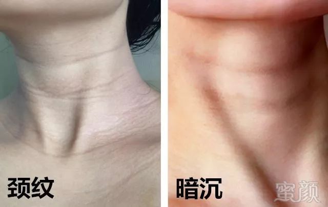 https://img.miyanlife.com/mnt/timg/180531/11292LG4-3.jpg