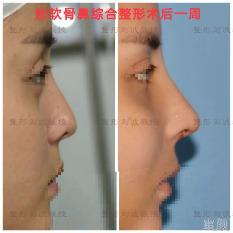 https://img.miyanlife.com/mnt/timg/180531/1131012934-5.jpg