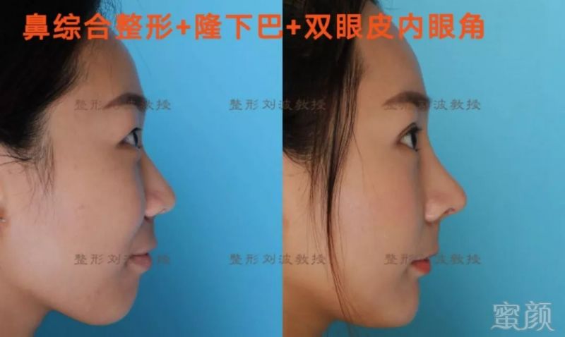 https://img.miyanlife.com/mnt/timg/180531/11310210D-6.jpg