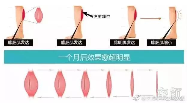 https://img.miyanlife.com/mnt/timg/180531/1131263D6-6.jpg