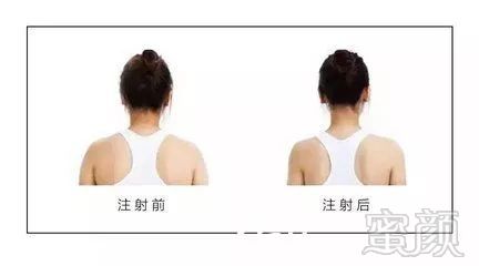 https://img.miyanlife.com/mnt/timg/180531/11312B163-7.jpg