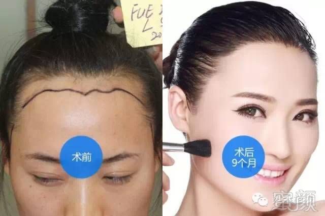 https://img.miyanlife.com/mnt/timg/180531/11402QU2-1.jpg