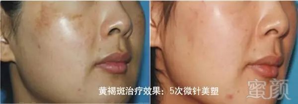 https://img.miyanlife.com/mnt/timg/180531/1153091A3-6.jpg