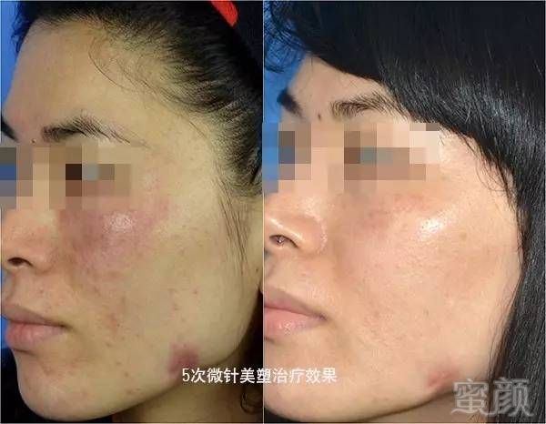 https://img.miyanlife.com/mnt/timg/180531/1153093939-9.jpg