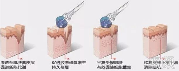 https://img.miyanlife.com/mnt/timg/180531/11530R964-5.jpg