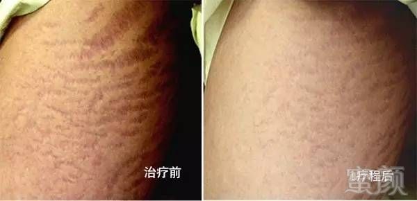 https://img.miyanlife.com/mnt/timg/180531/11530a509-8.jpg