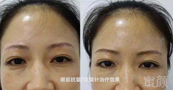 https://img.miyanlife.com/mnt/timg/180531/11530aN8-10.jpg