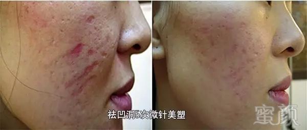 https://img.miyanlife.com/mnt/timg/180531/1153102542-12.jpg