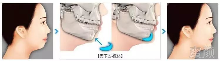 https://img.miyanlife.com/mnt/timg/180531/115HLC1-4.jpg