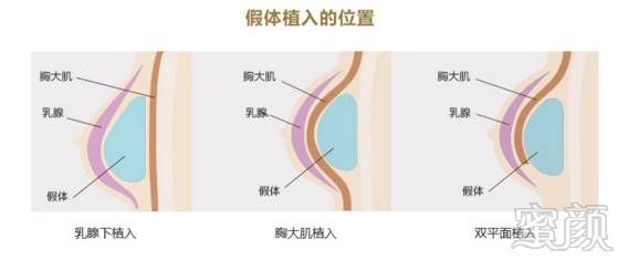 案例图片