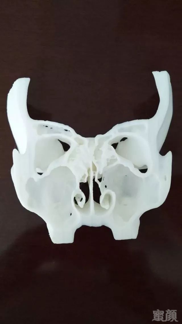 https://img.miyanlife.com/mnt/timg/180531/1211413L5-6.jpg 案例图片