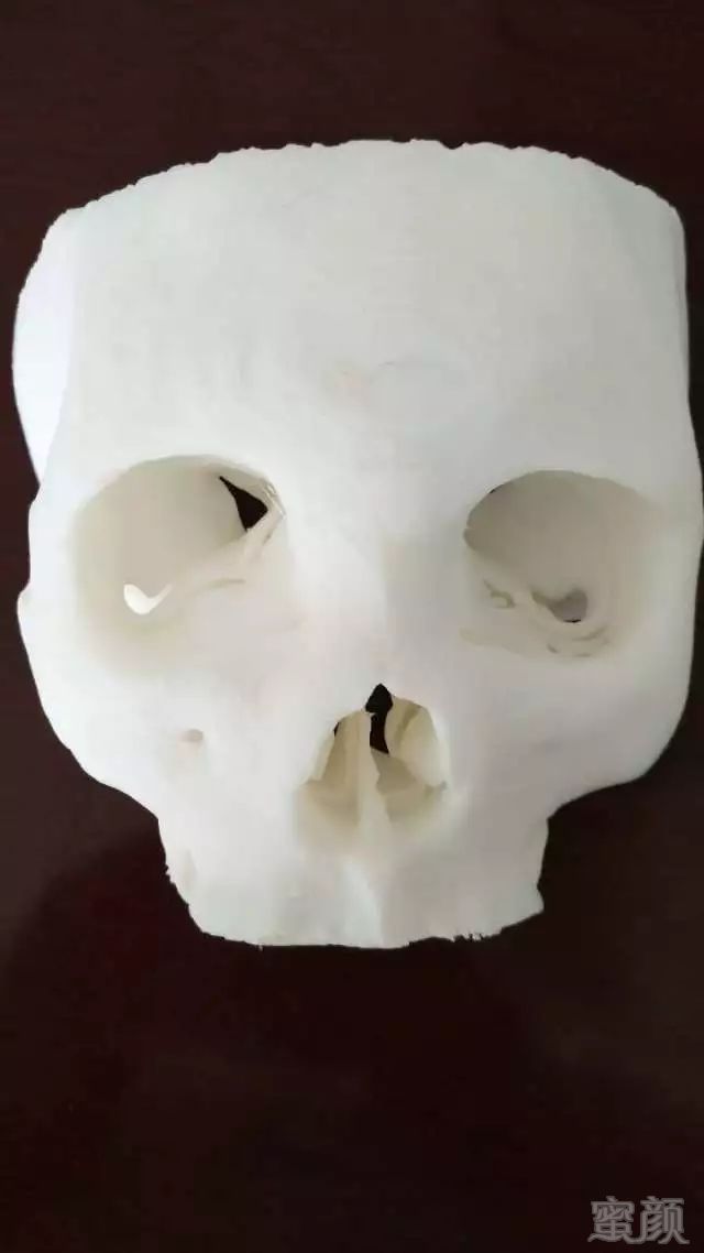 https://img.miyanlife.com/mnt/timg/180531/12114223Q-7.jpg 案例图片