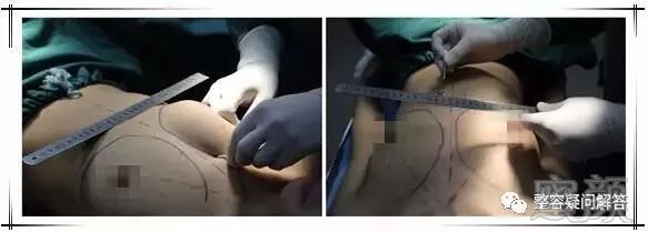 https://img.miyanlife.com/mnt/timg/180531/1214354W1-1.jpg