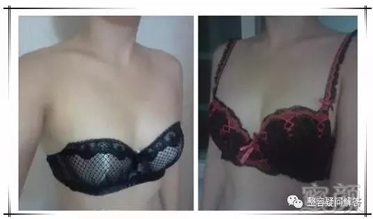 https://img.miyanlife.com/mnt/timg/180531/1214354Y6-0.jpg