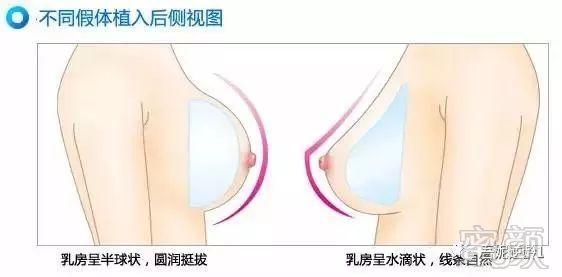 https://img.miyanlife.com/mnt/timg/180601/1100011617-1.jpg 案例图片