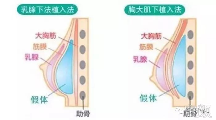 案例图片