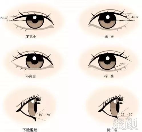 https://img.miyanlife.com/mnt/timg/180601/11000BH8-3.jpg
