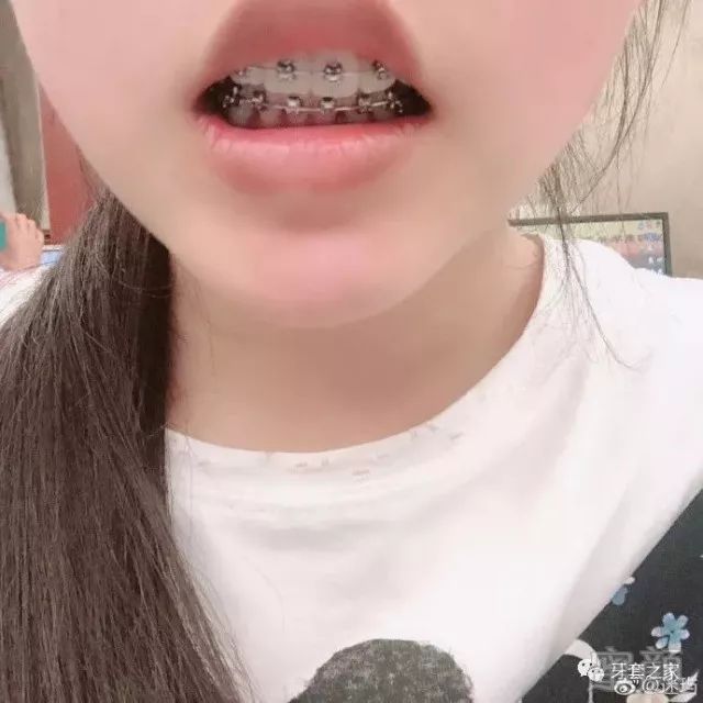 https://img.miyanlife.com/mnt/timg/180601/11043041T-2.jpg
