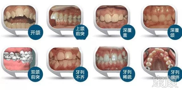 https://img.miyanlife.com/mnt/timg/180601/11150445G-2.jpg
