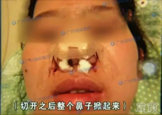 https://img.miyanlife.com/mnt/timg/180601/11205421J-2.jpg