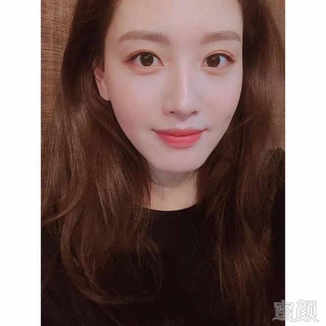 案例图片