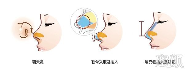 https://img.miyanlife.com/mnt/timg/180601/1140235052-2.jpg