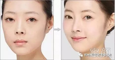 https://img.miyanlife.com/mnt/timg/180601/114124J40-0.jpg
