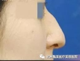 https://img.miyanlife.com/mnt/timg/180601/1141255I3-4.jpg