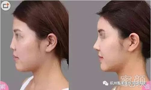 https://img.miyanlife.com/mnt/timg/180601/114125E42-7.jpg