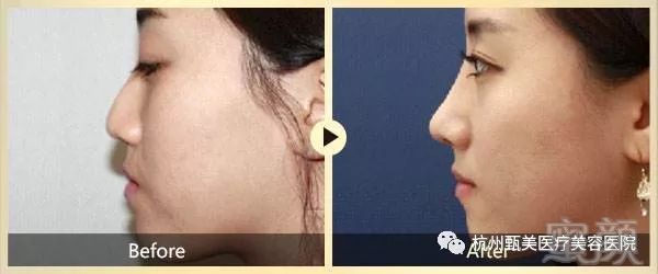 https://img.miyanlife.com/mnt/timg/180601/1141262262-9.jpg
