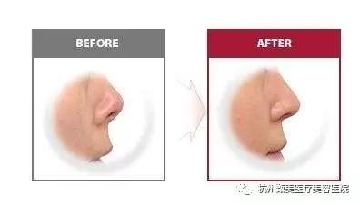 https://img.miyanlife.com/mnt/timg/180601/11412Ab5-10.jpg