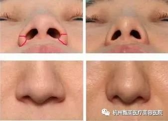 https://img.miyanlife.com/mnt/timg/180601/11412C514-11.jpg