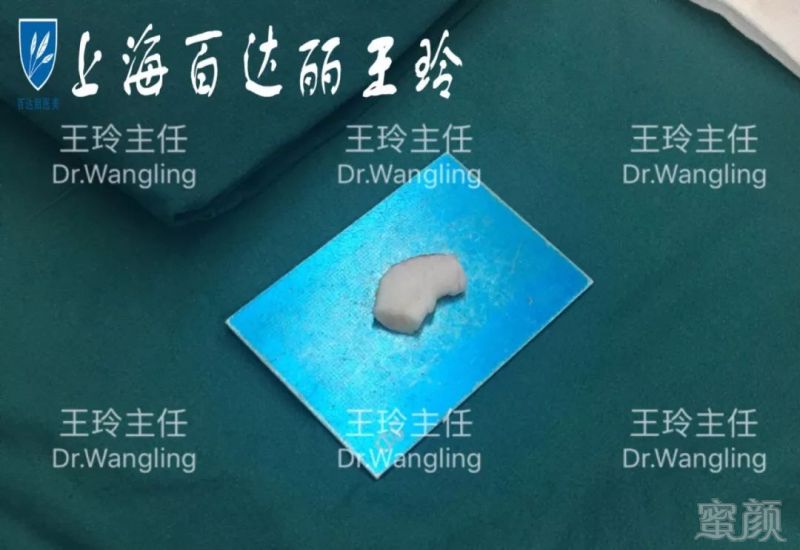 https://img.miyanlife.com/mnt/timg/180601/11414J3O-2.jpg