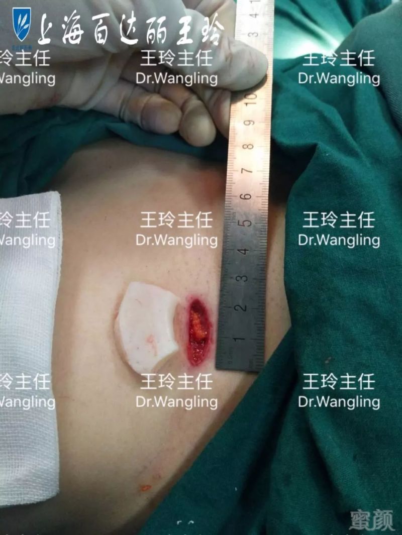 https://img.miyanlife.com/mnt/timg/180601/11414S132-3.jpg