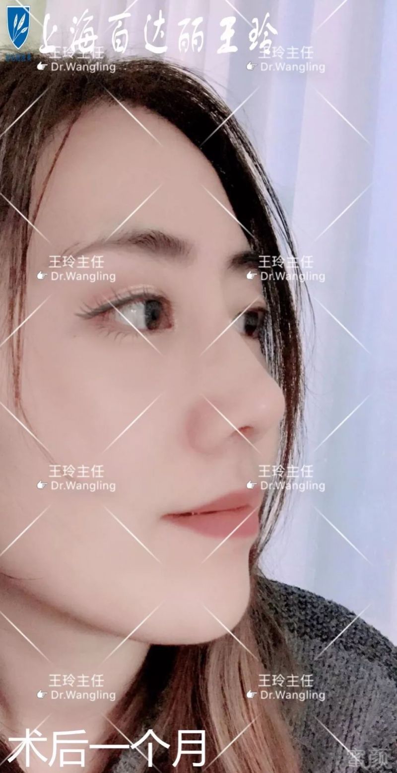 https://img.miyanlife.com/mnt/timg/180601/1141514249-7.jpg