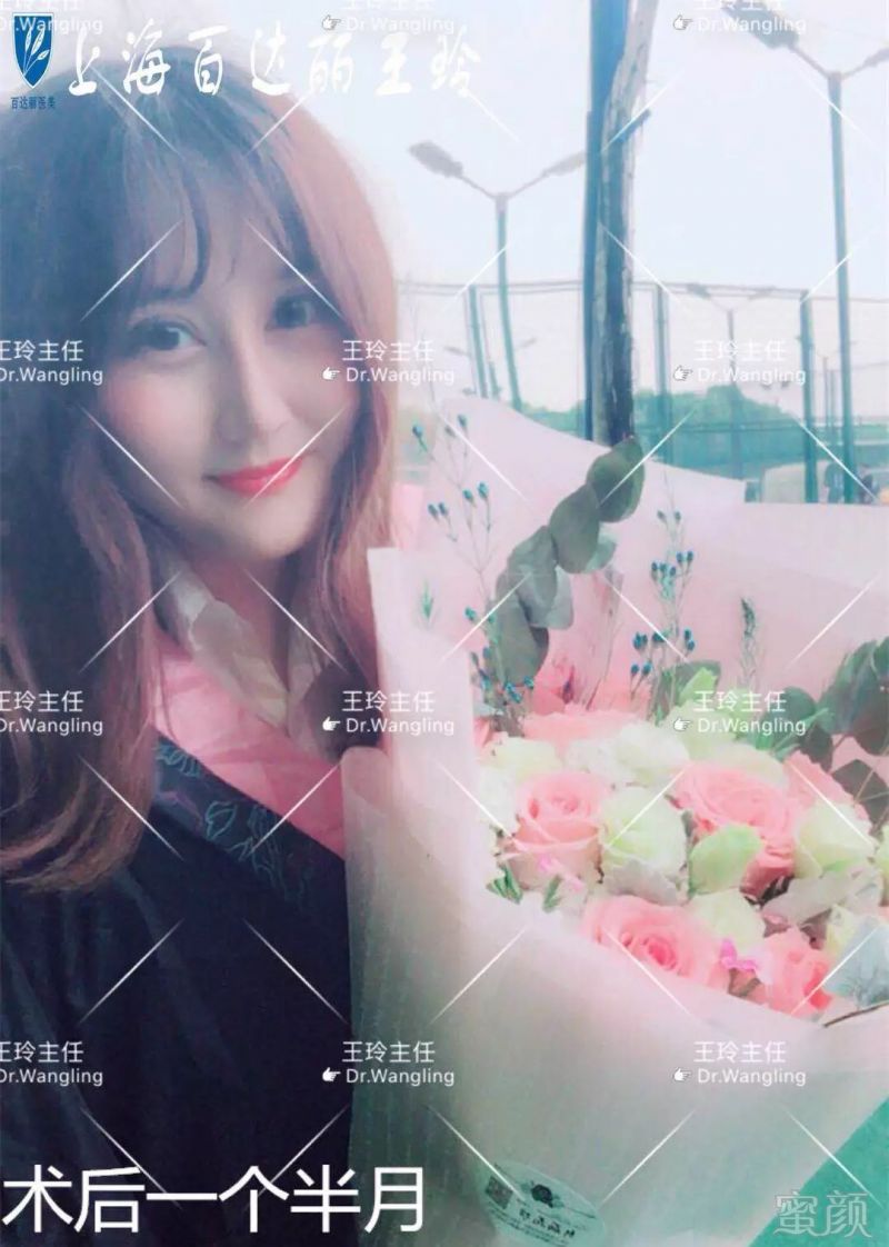 https://img.miyanlife.com/mnt/timg/180601/11415JA3-13.jpg