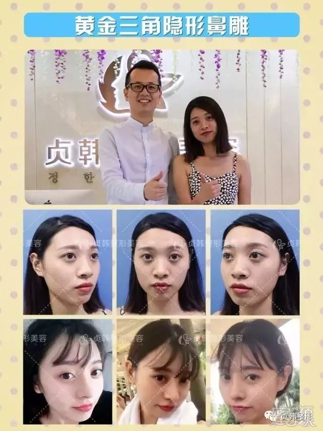 https://img.miyanlife.com/mnt/timg/180601/114425A50-5.jpg